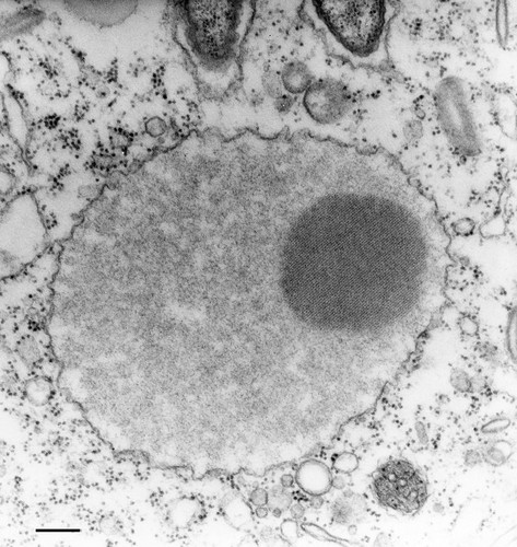 CIL:36672, Paramecium multimicronucleatum, cell by organism, eukaryotic cell, Eukaryotic Protist, Ciliated Protist