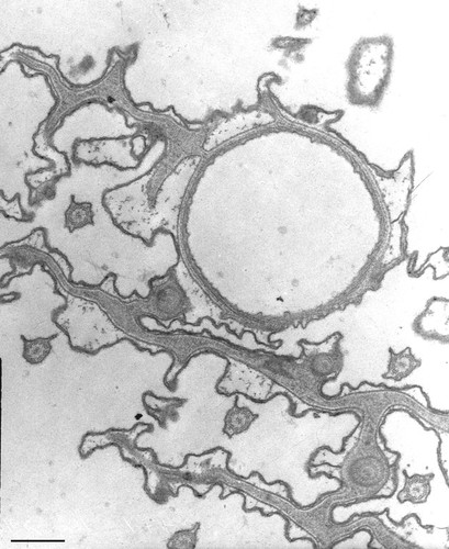 CIL:36758, Paramecium caudatum, cell by organism, eukaryotic cell, Eukaryotic Protist, Ciliated Protist