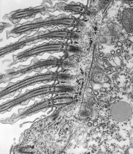 CIL:39129, Paramecium caudatum, cell by organism, eukaryotic cell, Eukaryotic Protist, Ciliated Protist