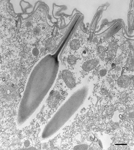 CIL:36667, Paramecium multimicronucleatum, cell by organism, eukaryotic cell, Eukaryotic Protist, Ciliated Protist