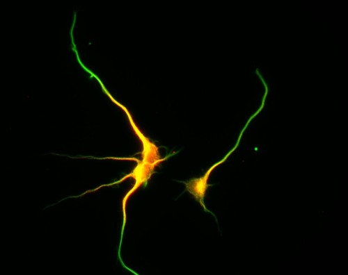 CIL:8460, Rattus, multipolar neuron