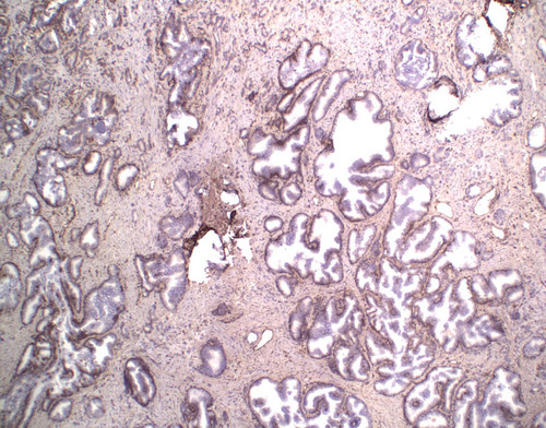 CIL:33225, Homo sapiens, endocrine-paracrine cell of prostate gland, basal cell of prostate epithelium, luminal cell of prostate epithelium, blood vessel endothelial cell, perineural cell, sheath cell, leukocyte, prostate stromal cell, smooth muscle cell of prostate