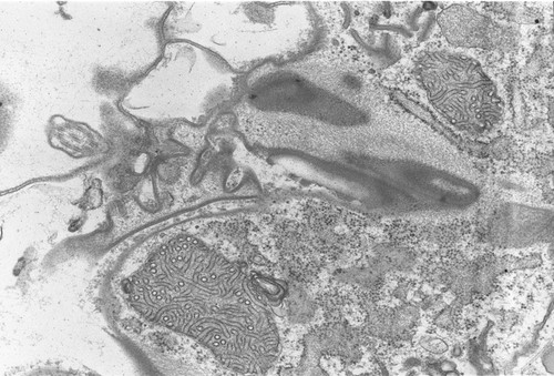 CIL:2866, Coleps hirtus, eukaryotic cell, Eukaryotic Protist, CIliated Protist