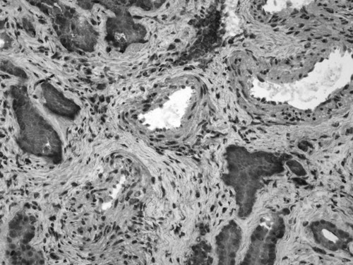 CIL:33672, Homo sapiens, endocrine-paracrine cell of prostate gland, basal cell of prostate epithelium, luminal cell of prostate epithelium, blood vessel endothelial cell, perineural cell, sheath cell, leukocyte, prostate stromal cell, smooth muscle cell of prostate