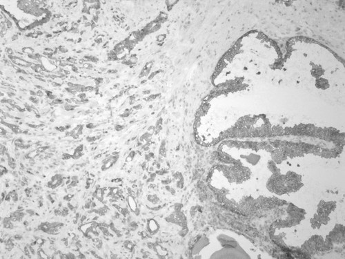 CIL:34227, Homo sapiens, endocrine-paracrine cell of prostate gland, basal cell of prostate epithelium, luminal cell of prostate epithelium, blood vessel endothelial cell, perineural cell, sheath cell, leukocyte, prostate stromal cell, smooth muscle cell of prostate