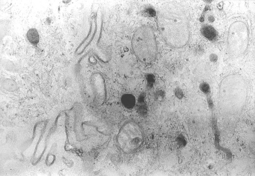 CIL:47752, Homo sapiens, duct epithelial cell