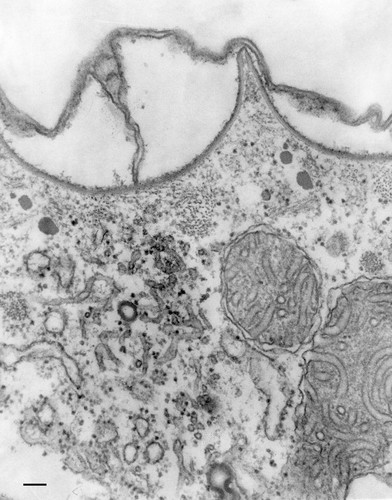 CIL:36598, Paramecium multimicronucleatum, cell by organism, eukaryotic cell, Eukaryotic Protist, Ciliated Protist