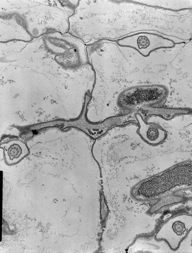 CIL:9017, Coleps hirtus, eukaryotic cell, Eukaryotic Protist, Ciliated Protist