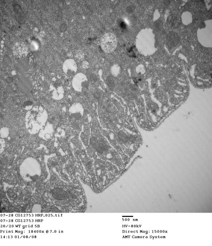 CIL:13471, Drosophila melanogaster, garland cell