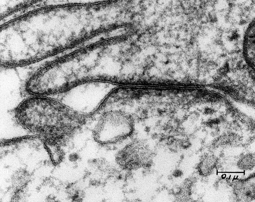 CIL:37172, kidney cell