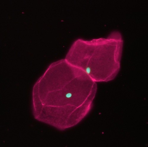 CIL:40968, Homo sapiens, epithelial cell