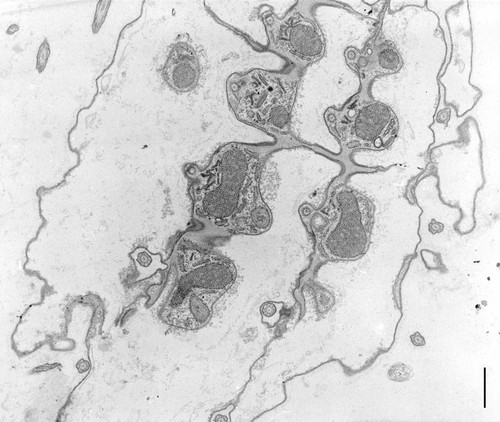 CIL:9695, Coleps hirtus, eukaryotic cell, Eukaryotic Protist, Ciliated Protist