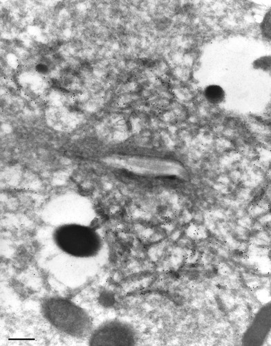 CIL:26265, Paramecium multimicronucleatum, cell by organism, eukaryotic cell, Eukaryotic Protist, Ciliated Protist