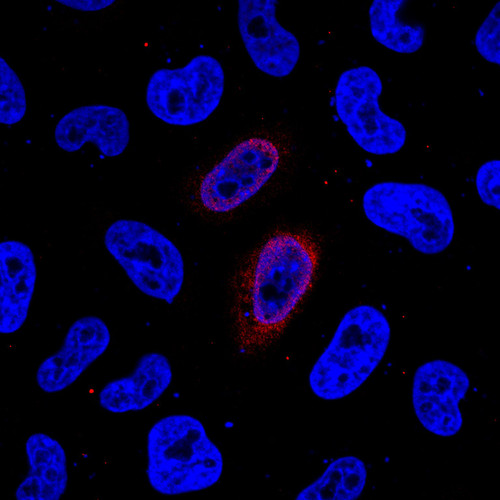 CIL: 53753, Homo sapiens, HeLa