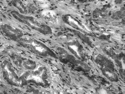 CIL:34063, Homo sapiens, endocrine-paracrine cell of prostate gland, basal cell of prostate epithelium, luminal cell of prostate epithelium, blood vessel endothelial cell, perineural cell, sheath cell, leukocyte, prostate stromal cell, smooth muscle cell of prostate