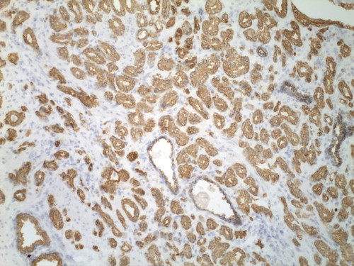 CIL:34240, Homo sapiens, endocrine-paracrine cell of prostate gland, basal cell of prostate epithelium, luminal cell of prostate epithelium, blood vessel endothelial cell, perineural cell, sheath cell, leukocyte, prostate stromal cell, smooth muscle cell of prostate
