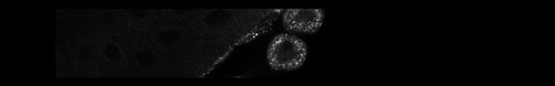 CIL:13479, Drosophila melanogaster, garland cell