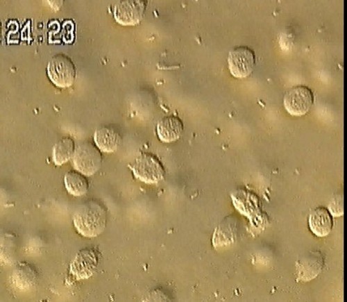 CIL:35191, Danio rerio, Bacillus subtilis, Escherichia coli, macrophage, erythroblast