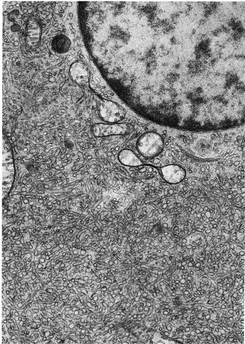 CIL:10800, Didelphimorphia, Leydig cell