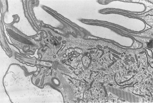 CIL:2872, Coleps hirtus, eukaryotic cell, Eukaryotic Protist, Ciliated Protist