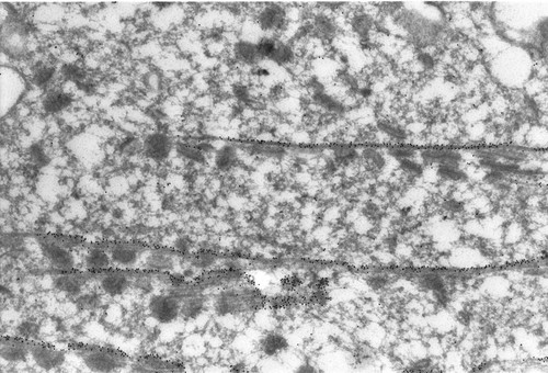 CIL:1309, Paramecium tetraurelia, cell by organism, eukaryotic cell, Eukaryotic Protist, Ciliated Protist