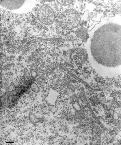 CIL:13108, Paramecium multimicronucleatum, cell by organism, eukaryotic cell, Eukaryotic Protist, Ciliated Protist