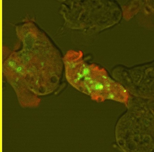 CIL:7653, Dictyostelium discoideum, cell by organism, eukaryotic cell, amoeboid cell, Eukaryotic Protist