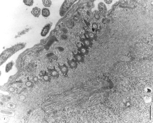 CIL:10013, Didinium nasutum, eukaryotic cell, Eukaryotic Protist, Ciliated Protist