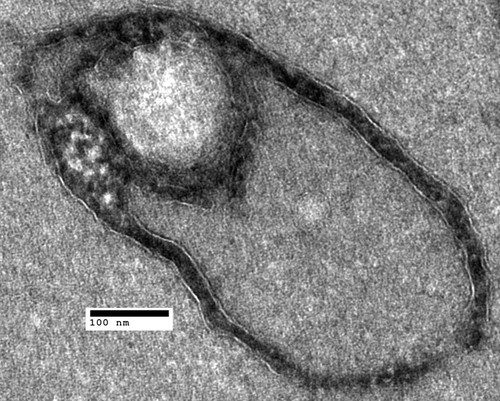 CIL:40418, Saccharomyces cerevisiae, BY4716