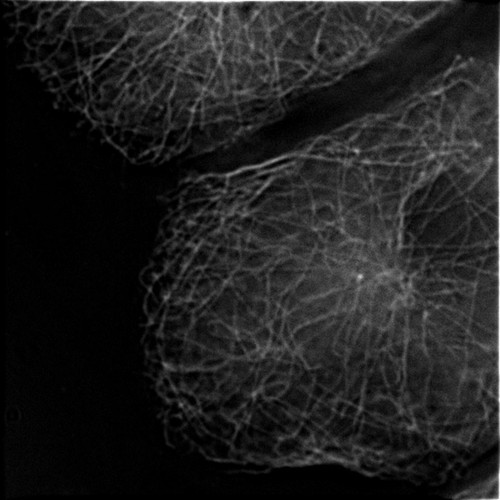 CIL:35281, Rattus rattus, hepatocyte