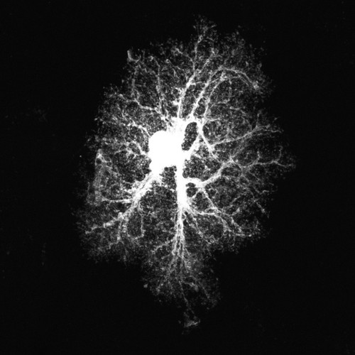 CIL:39938, Rattus norvegicus, astrocyte, astrocyte of the hippocampus