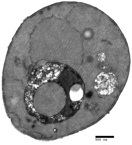 CIL:40435, Saccharomyces cerevisiae, swa2 mutant