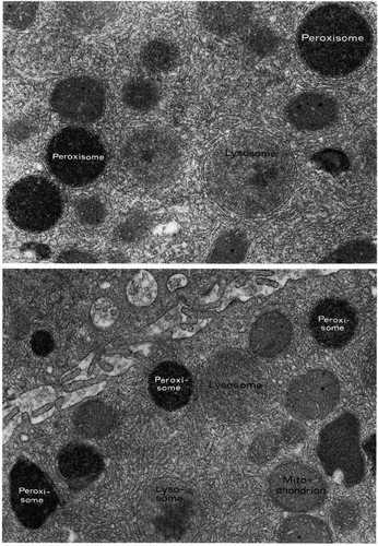 CIL:11487, Sus scrofa, Leydig cell