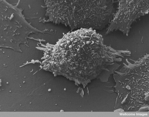 CIL:39106, lung cancer cell