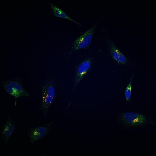 CIL:13551, Homo sapiens, epithelial cell, cervical carcinoma