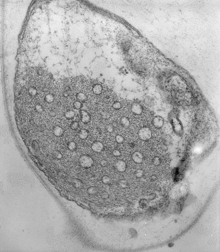 CIL:39511, Vorticella convallaria, cell by organism, eukaryotic cell, Eukaryotic Protist, Ciliated Protist