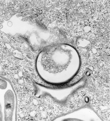 CIL:39506, Vorticella convallaria, cell by organism, eukaryotic cell, Eukaryotic Protist, Ciliated Protist