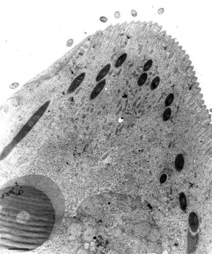 CIL:12300, Didinium nasutum, cell by organism, eukaryotic cell, Eukaryotic Protist, Ciliated Protist