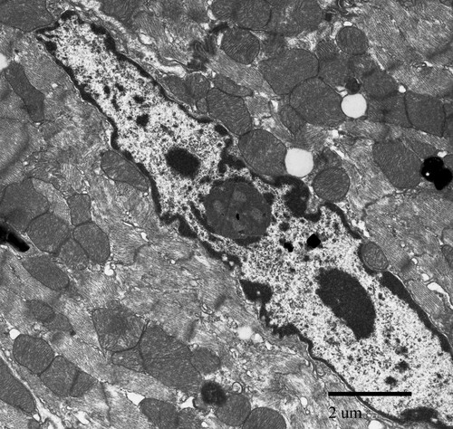 CIL:39755, Mus musculus, cardiac muscle cell