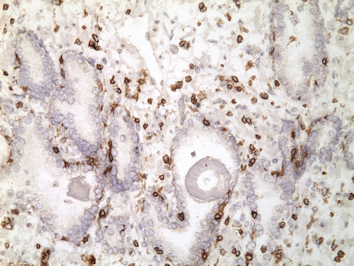 CIL:33232, Homo sapiens, endocrine-paracrine cell of prostate gland, basal cell of prostate epithelium, luminal cell of prostate epithelium, blood vessel endothelial cell, perineural cell, sheath cell, leukocyte, prostate stromal cell, smooth muscle cell of prostate