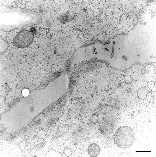 CIL:20813, Paramecium multimicronucleatum, cell by organism, eukaryotic cell, Eukaryotic Protist, Ciliated Protist