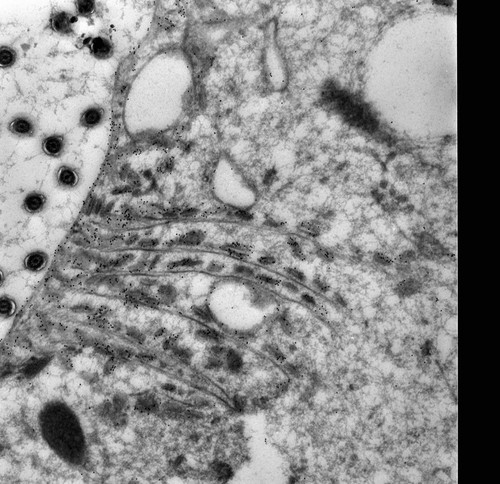 CIL:40555, Paramecium multimicronucleatum, cell by organism, eukaryotic cell, Eukaryotic Protist, Ciliated Protist