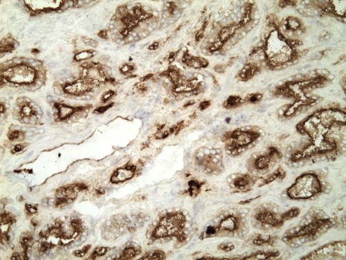 CIL:32536, Homo sapiens, endocrine-paracrine cell of prostate gland, basal cell of prostate epithelium, luminal cell of prostate epithelium, blood vessel endothelial cell, perineural cell, sheath cell, leukocyte, prostate stromal cell, smooth muscle cell of prostate