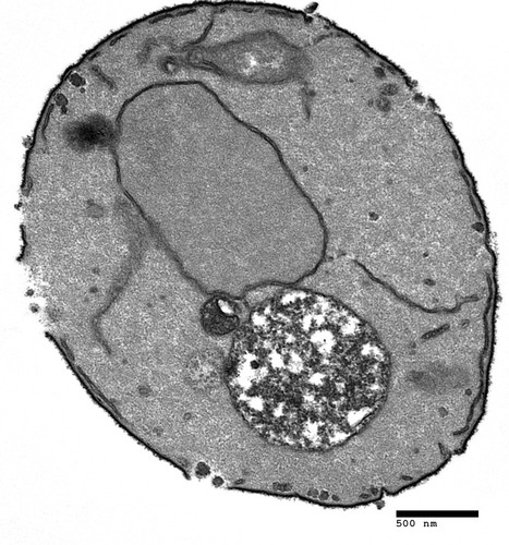 CIL:40449, Saccharomyces cerevisiae, vma9 mutant