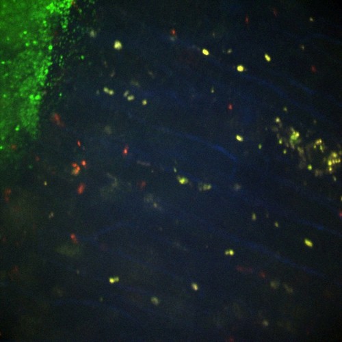 CIL:47573, Staphylococcus aureus, neutrophil, endothelial cell