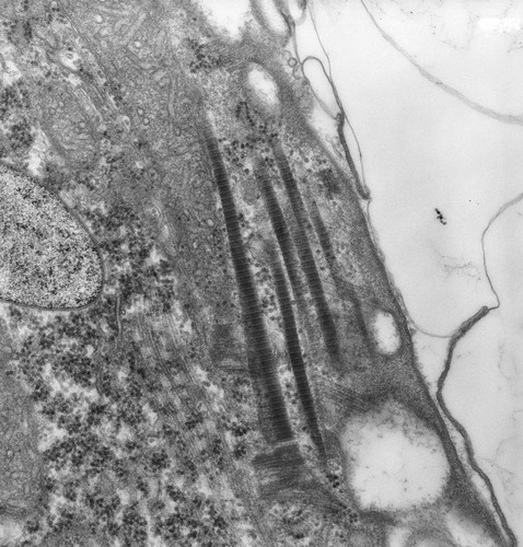 CIL:25901, uncultured scuticociliate, Conchophthirus curtus, cell by organism, eukaryotic cell, Eukaryotic Protist, Ciliated Protist