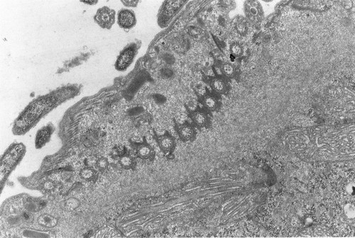 CIL:4663, Didinium nasutum, eukaryotic cell, Eukaryotic Protist, Ciliated Protist