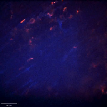 CIL:47562, Staphylococcus aureus, neutrophil, endothelial cell