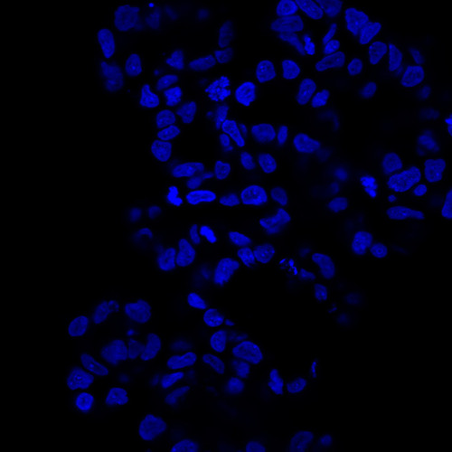 CIL: 54793, Homo sapiens, SBAD2 human iPSC line