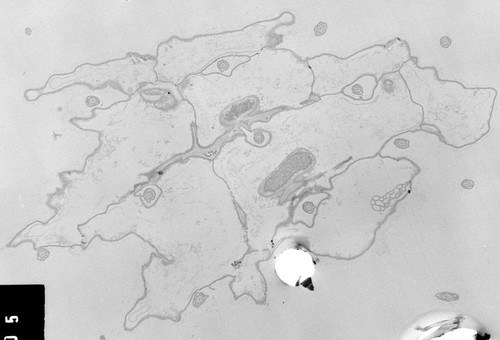 CIL:38830, Coleps hirtus, eukaryotic cell, Eukaryotic Protist, Ciliated Protist